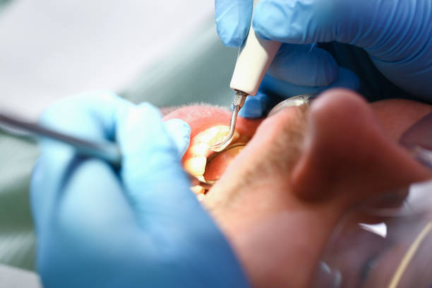 Best Tooth Infection Emergency Dentist  in Spindale, NC